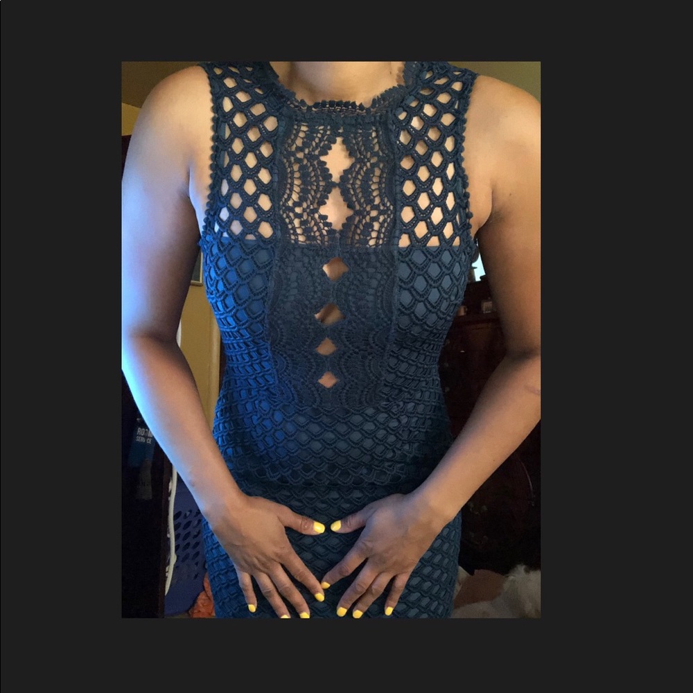 Dark green lace dress with zipper